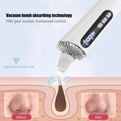 Electric Blackhead Remover